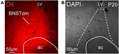 Ontogeny of the Projections From the Dorsomedial Division of the Anterior Bed Nucleus of the Stria Terminalis to Hypothalamic Nuclei